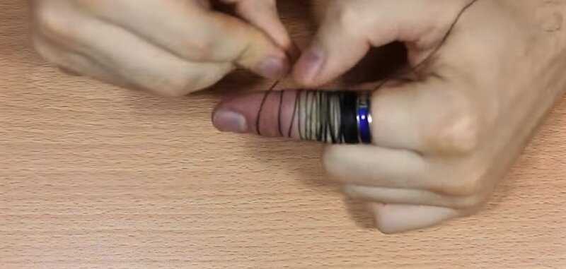 Способы снятия кольца с отекшего пальца