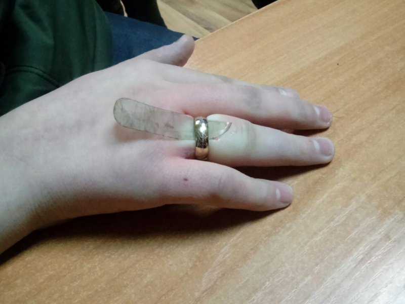 Как снять кольцо с пальца (49 фото): как удалить с отекшего или опухшего пальца колечко с помощью нитки