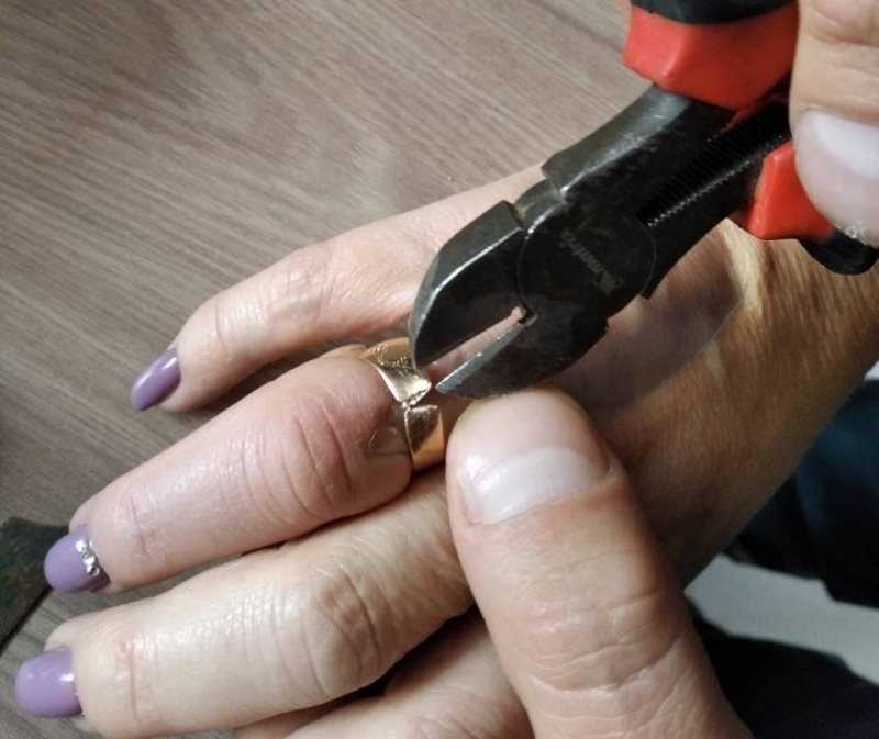 Как снять кольцо с опухшего пальца – 10 способов