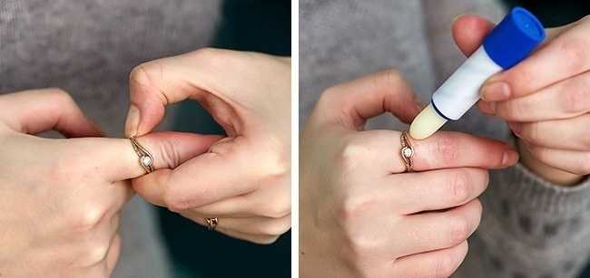 Как снять кольцо с опухшего пальца - разберем лучшие способы