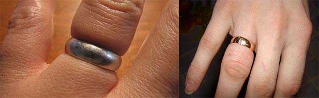 Как самостоятельно снять кольцо с опухшего пальца: причины проблемы и способы ее решения